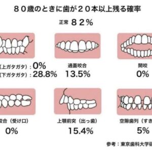 ①歯並びと生活寿命の統計です  ②WEBライブセミナー　「なんでも相談 ＆ なんでも質問」　無料