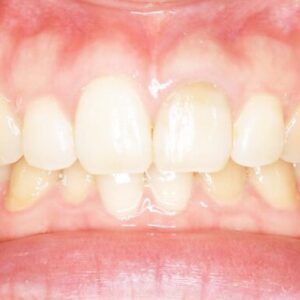 プレオルソ　ユーティリティ