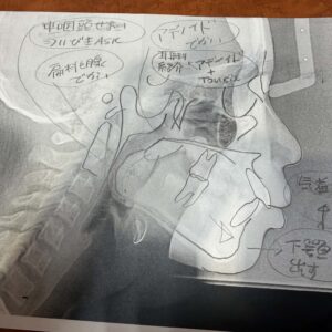 矯正歯科と耳鼻科、なぜ連携するの？